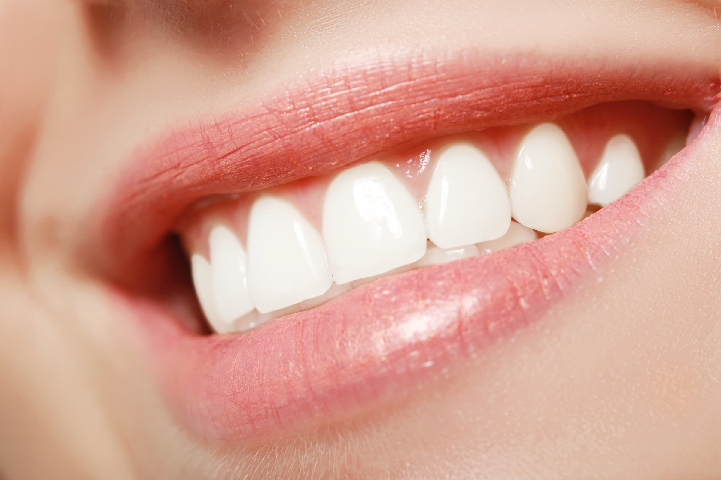 A close, natural smile after porcelain veneer treatment