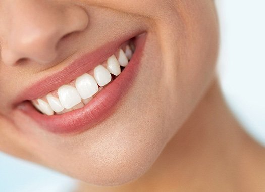 Choosing tooth-colored fillings has many benefits in Plainview, NY