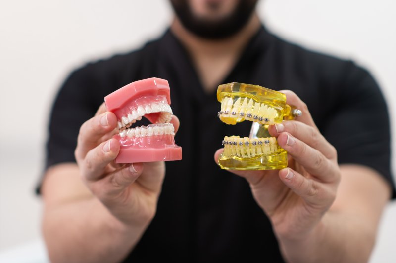 A dentist holding a jaw mockup with Invisalign trays and another with metal braces