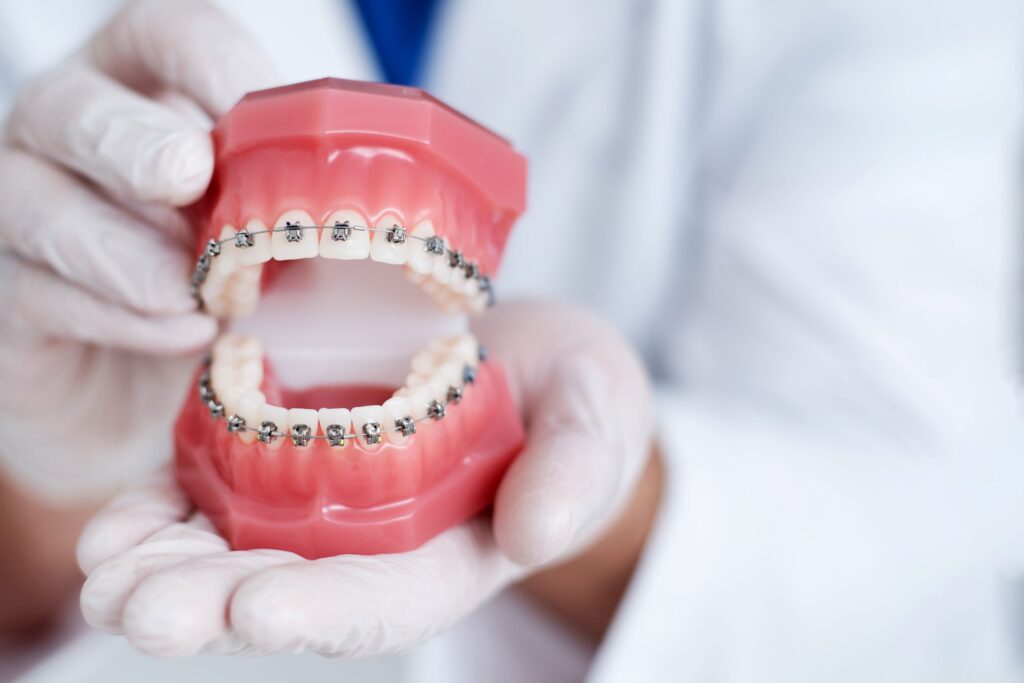 Dentist holding model teeth with braces