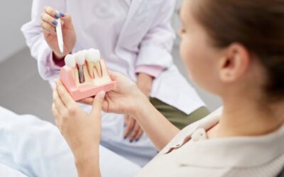 The Usual Suspects: 4 Common Post-Op Dental Implant Surgery Questions
