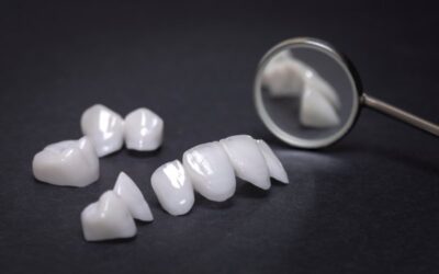 Veneers or Dental Crowns: What to Pick?